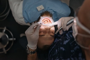 Unveiling the Secrets of Manly Dentistry: Your Guide to Top-Notch Root Canal Treatment